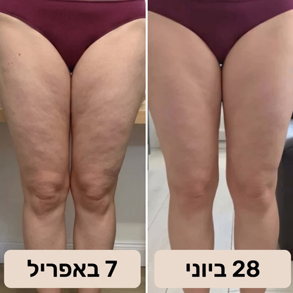 הטייץ של -LUMERO